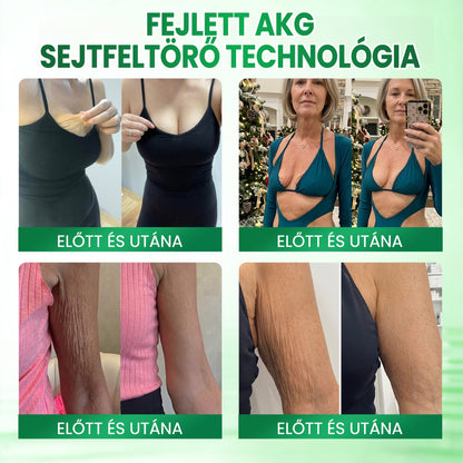 💟Medistart® AKG BŐRFESZESÍTŐ & ÖREGEDÉS ELLENI ÁPOLÁS 👍