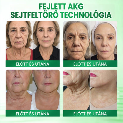 💟Medistart® AKG BŐRFESZESÍTŐ & ÖREGEDÉS ELLENI ÁPOLÁS 👍