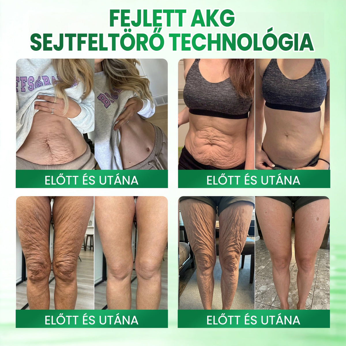 💟Medistart® AKG BŐRFESZESÍTŐ & ÖREGEDÉS ELLENI ÁPOLÁS 👍