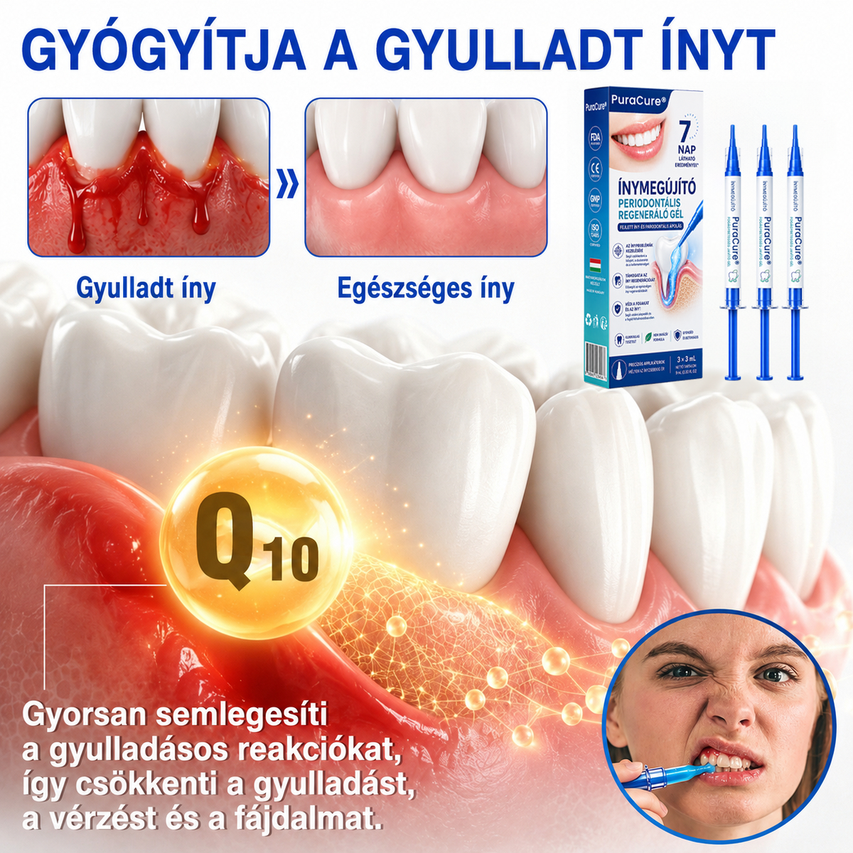 🇭🇺👨‍⚕️✅🦷 PuraCure® ÍNYMEGÚJÍTÓ – Parodontális helyreállító gél🧂