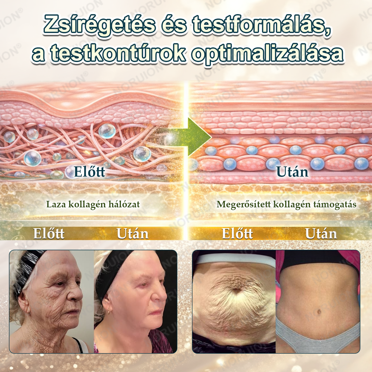 👩‍⚕️ NORUION® AKG Sejtszintű Metabolikus Aktiváló Szérum 🔥🔥